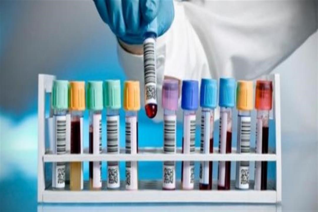 Small Check-Up Profile (1)